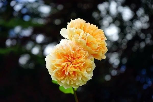 百萬醫(yī)療保險檢查費報銷嗎？怎樣報銷？